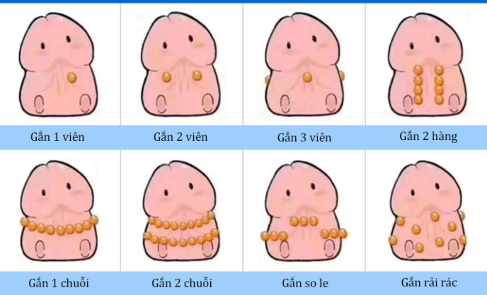 Găm bi dương vật: Lợi & hại bạn cần biết trước khi thử 5 Các kiểu gán bi dương vật